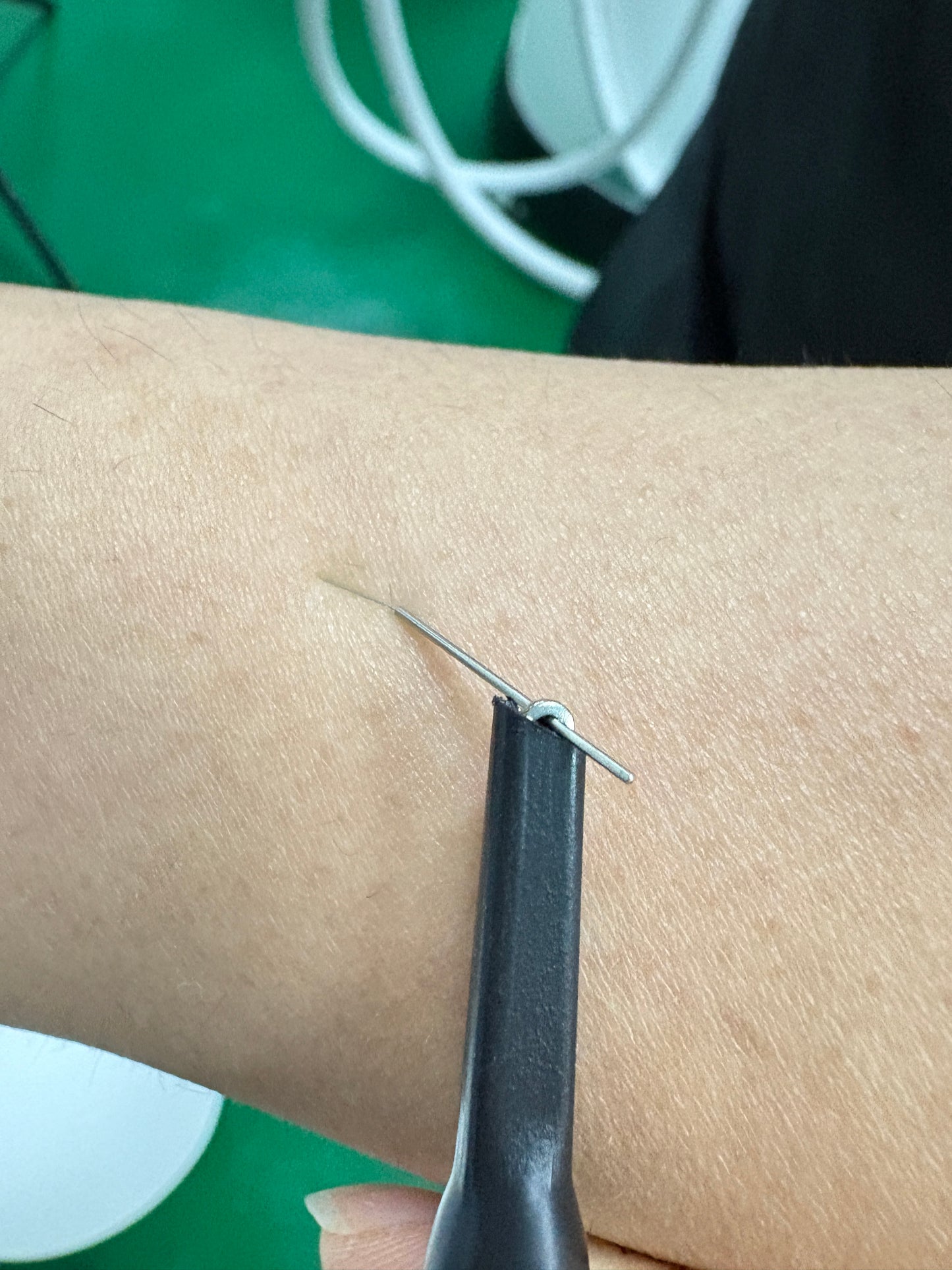 400RBS Spider vein removal device